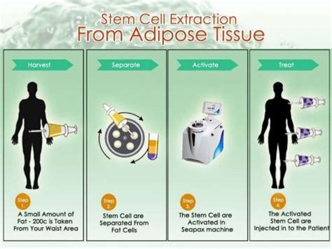 Stem Cells Therapy Stem Cell Therapy Stem Cells Adipose Tissue