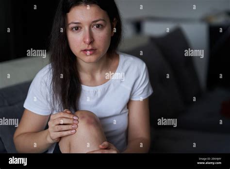 Portrait Of Beaten Woman With Tears Of Her Face And Bruise On Knee Sit On The Sofa Stock Photo