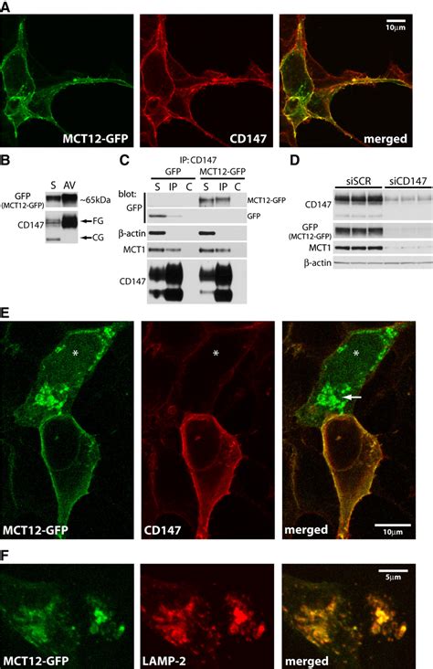Alex van der eb, who was involved in the development of hek 293, is quoted: MCT12 is a heteromeric transporter. (A) HEK-293:MCT12- GFP ...