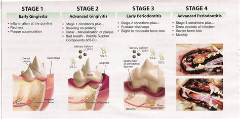 Dog periodontal disease is a progressive type of disease, which cannot be completely healed if the dental plaque is not completely removed, but which it is one of the most common infectious diseases in dogs and it is caused by bacteria that form dental plaque. Does My Pet Need a Dental? What's Involved in Dental ...