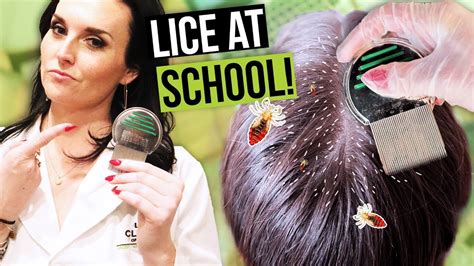 Head Lice At School Simple At Home Head Lice Treatment Youtube