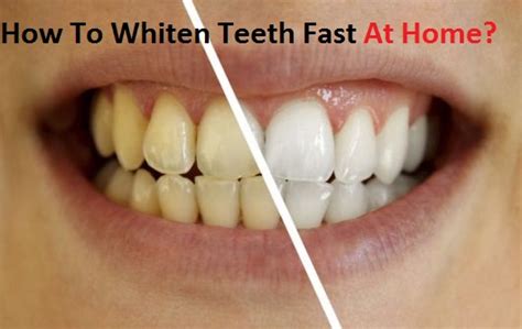 Baking soda cleans as well as whitens, but is abrasive, so use it infrequently (just once or twice a month). How to Whiten Teeth Fast at Home?