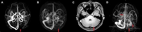 Frontiers Anatomy Imaging And Hemodynamics Research On The Cerebral