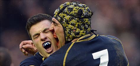 El seleccionado de la rosa revalidó el título conseguido hace un año y se sigue afianzando tras el papelón que significó quedar afuera en primera rueda en la copa del mundo. Escocia - Equipos - Torneo Seis Naciones de Rugby 2015 en ...