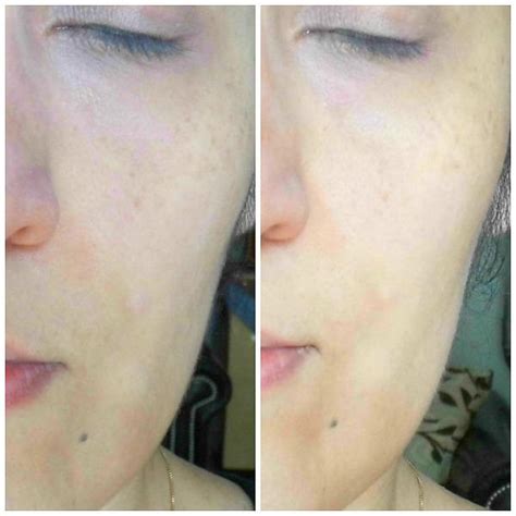 Hallo zusammen, in diesem video erzähle ich euch alles über die diamant microdermabrasion. PMD Personal Microderm at Home - Review - Madame Keke ...