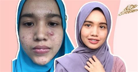 Lembaga air perak merupakan pembekal air bersih untuk keperluan semua, termasuk penduduk di dalam dan di luar bandar serta sektor perdagangan dan industri. Guna air filter (bukan paip), hasil 4 bulan jerawat serius ...