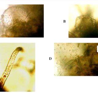 In the case of cannabis, trichomes also contain thc, the chemical compound that provides a. (PDF) Glandular Trichomes, Secretory Cavities and ...