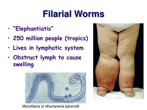 Ppt Ch 11 Pseudocoelomates Soo Doe See Low Mates” Powerpoint