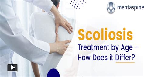 PPT – Scoliosis Treatment by Age: A Comprehensive Guide | Mehta Spine