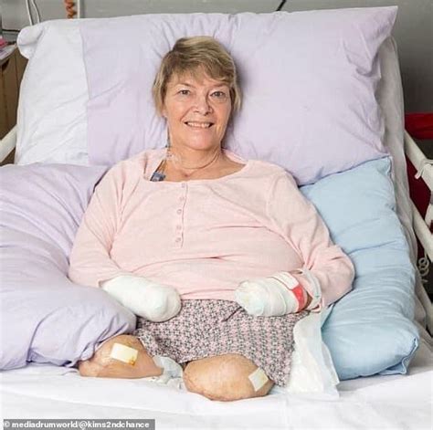 Grandmother 60 Had All Of Her Limbs Amputated After She Contracted