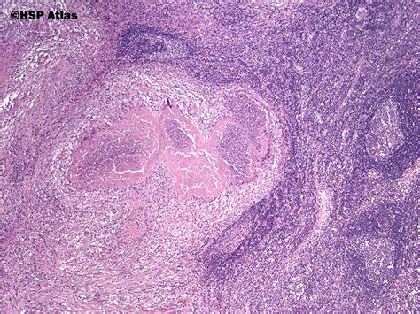 Hsp Atlas Histopathology Atlas