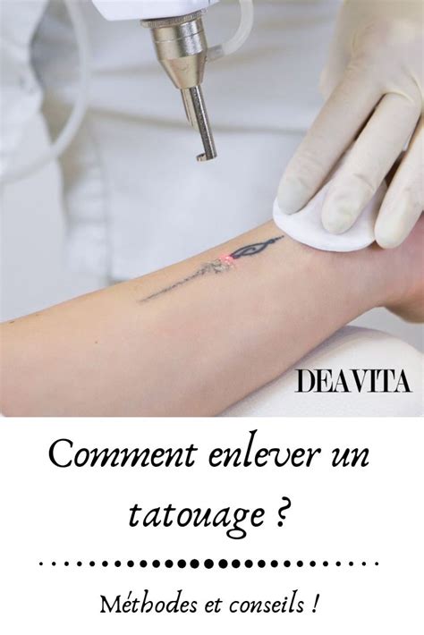 Comment Enlever Un Tatouage Enlever Un Tatouage Comment Enlever Un Tatouage Tatouage