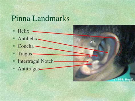 Ear Anatomy Pinna Tragus