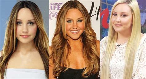 Amanda Bynes Before And After