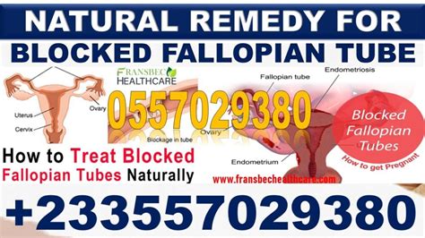 Herbal Medicine For Blocked Fallopian Tubes In Ghana