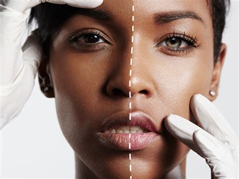 Ivory Coast Officials Announce A Ban On The Use Of Skin Whitening Creams