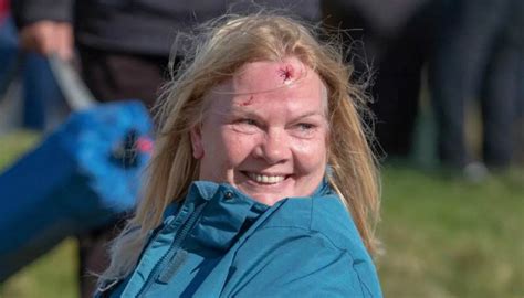 Be sure to log in with the cpanel user that owns the domain you are resetting the dns zone for. Golf: Spectator struck on head by ball at Dunhill Links ...