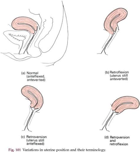 Pin On Ultrasound Uterine Anatomy
