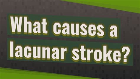 What Causes A Lacunar Stroke Youtube