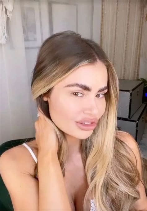 Chloe Sims Incredible Plastic Surgery Make Under As Towie Star Dissolves The Fillers Irish