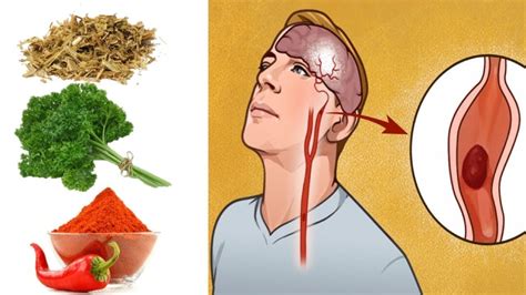 6 Herbs That Unclog Arteries And Improve Blood Circulation Youtube