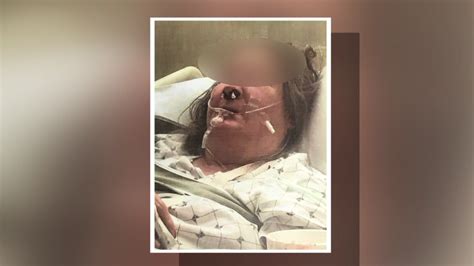 Reward Offered For Suspects After 73 Year Old Woman Beaten Nearly