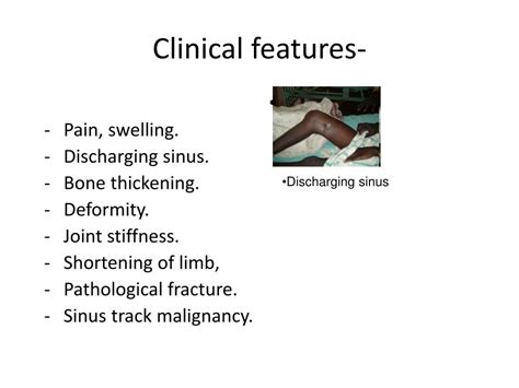 Ppt Chronic Osteomyelitis Powerpoint Presentation Free Download Id