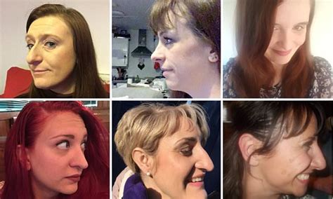 twitter users share photos of big noses to break the taboo