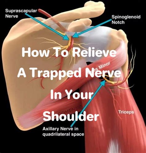 How To Relieve A Trapped Nerve In Your Shoulder Nerve Pain Relief