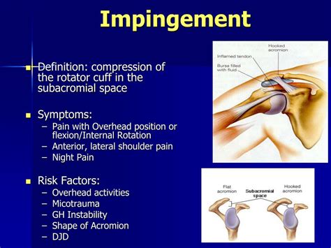 Ppt Common Shoulder Problems Powerpoint Presentation Free Download