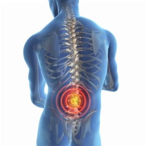 Lower Back Pain Lumbago Symptoms Causes And Treatment