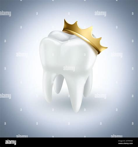 Molar Crown Hi Res Stock Photography And Images Alamy