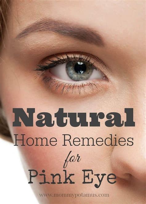 5 Natural Remedies For Pink Eye | Natural pink eye remedy ...
