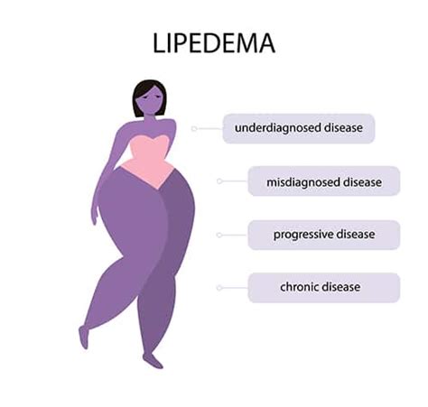 Lipedema Surgery Center Is Dedicated To Treatment Of Lipedema