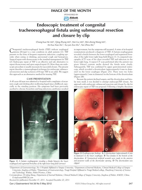 pdf endoscopic treatment of congenital tracheoesophageal fistula using submucosal resection