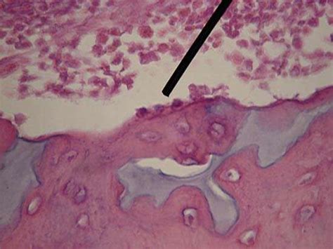 Osteoblast Cell