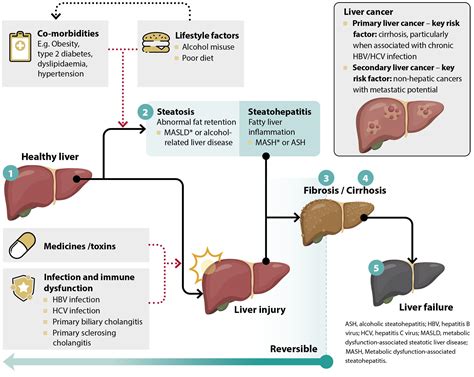 Liver function tests in primary care - bpacnz