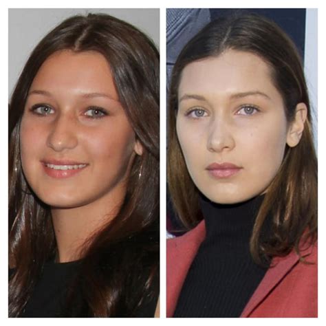 bella hadid from 14 to 16 before and after her nose job r kuwtk