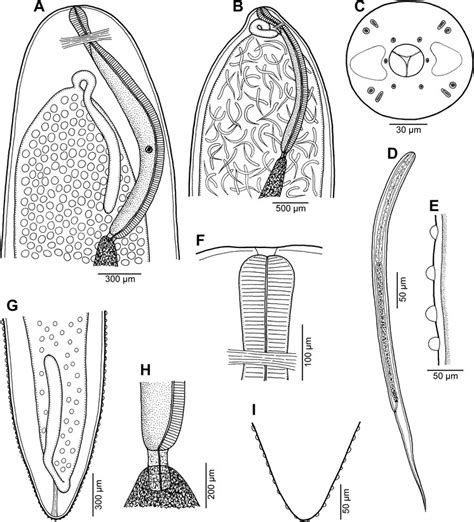 Philometroides Stomachicus N Sp From Protonibea Diacanthus Females