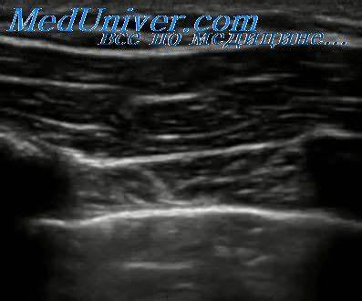 Консервативное лечение стабильной стенокардии. Образ жизни при стенокардии Картинка - Консервативное лечение стабильной стенокардии. Образ жизни при стенокардии