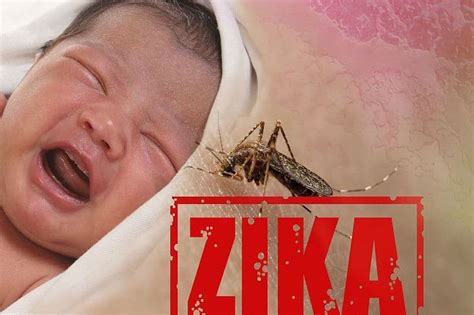 The Zika Virus Is Spreading Heres How To Stop It