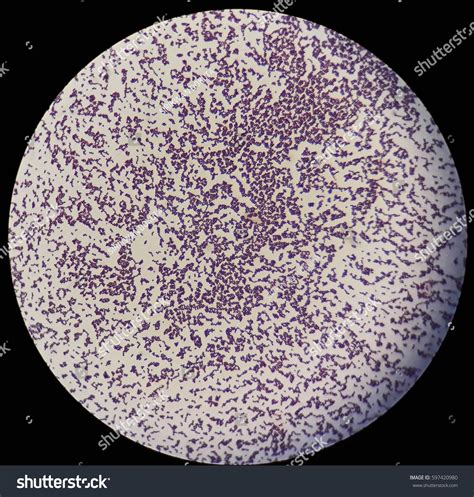 Smear Gram Positive Cocci Bacteria Under Stockfoto 597420980 Shutterstock