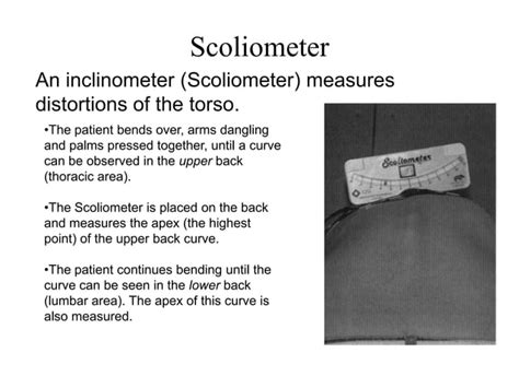 Orthotic Management Of Scoliosis