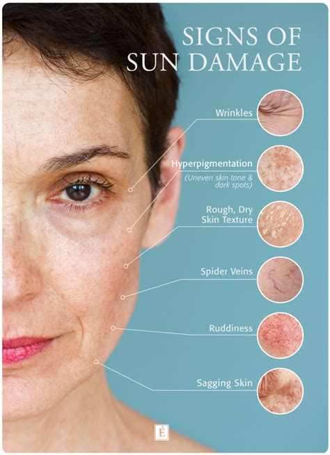 What Does Sun Damaged Skin Look Like Sagging Skin Sun Damaged Skin