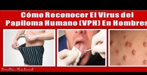 Pasos Para Detectar El Virus Del Papiloma En Hombres Con Respecto