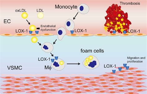 Role Of Lectin Like Oxidized Low Density Lipoprotein Ldl Receptor 1 Download Scientific