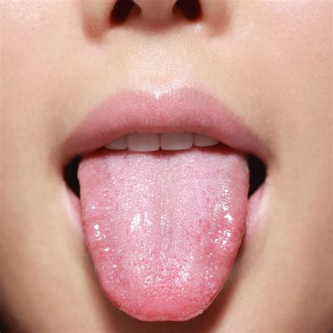 11 Things Your Mouth Can Tell You About Your Health