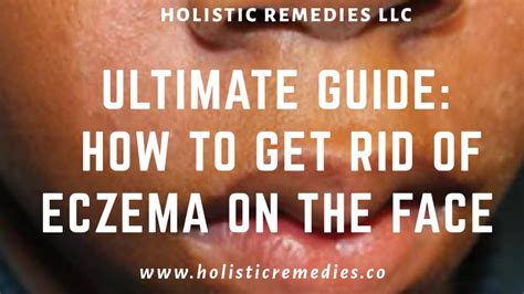 Ultimate Guide How To Get Rid Of Eczema On The Face Infographic