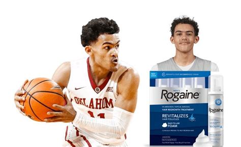 Trae Young Signs 300m Deal With Rogaine To Be A Hair Model
