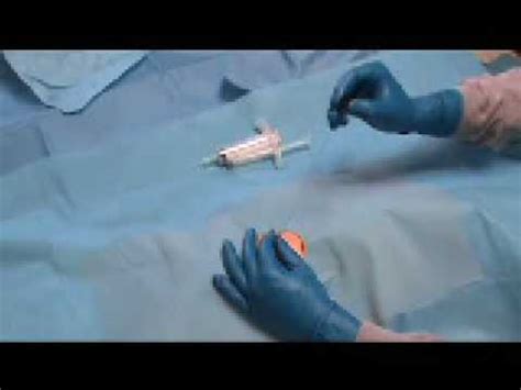 Fine Needle Aspiration Biopsy Fna Using A Needle With A Stylet Or